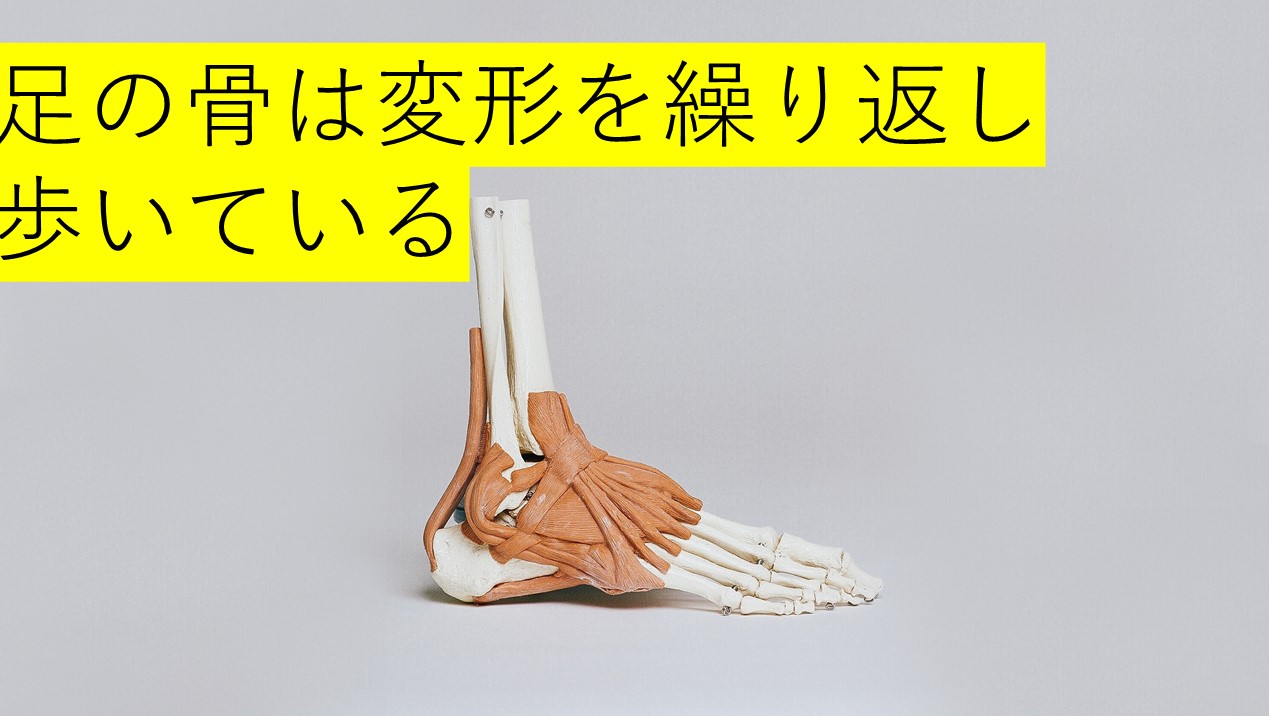 内反小趾の治療法とは。効果的な矯正法はあるのか？｜外反母趾を治す！