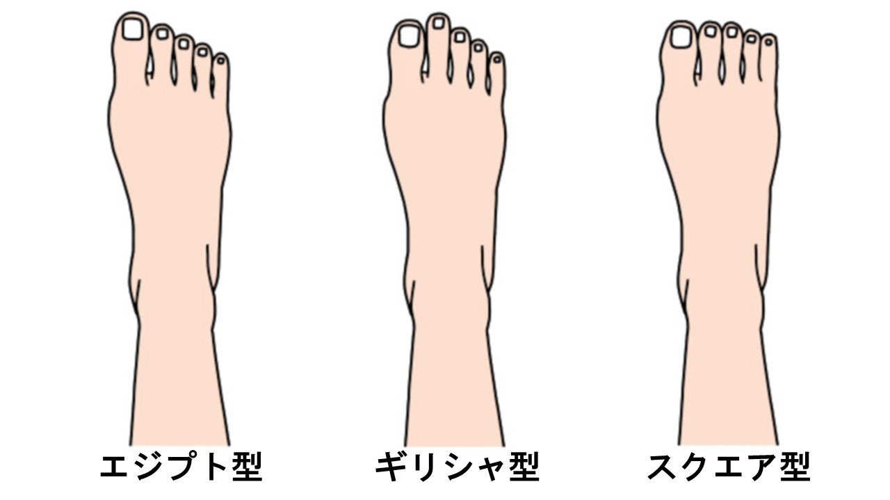 外反母趾は遺伝が一番の原因なのか どうしようもないのか 外反母趾を治す