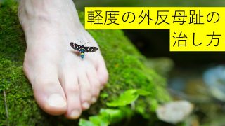 外反母趾の一般的な治し方 外反母趾を治す