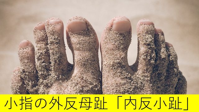 外反母趾を治す 外反母趾改善のための情報サイト